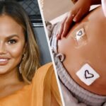 Chrissy Teigen Shared An Unfiltered Photo Of Her Endometriosis Scars With An Empowering Message Of Self-Love