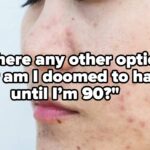 22 Questions About Acne, Wrinkles, And More Answered By A Dermatologist